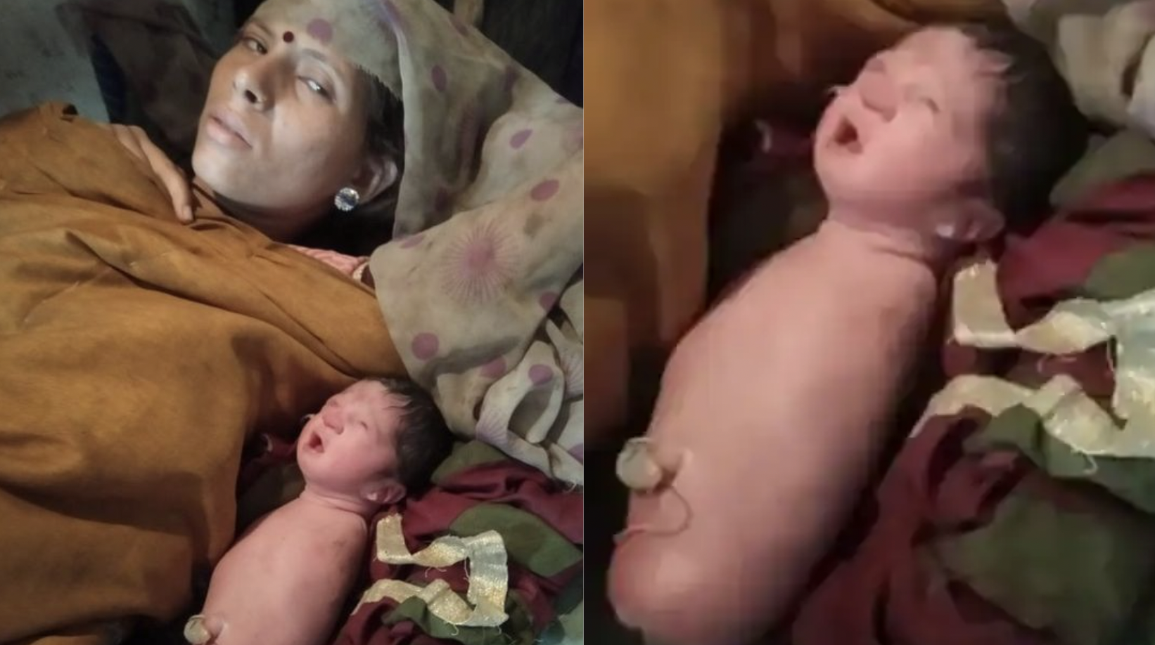मध्य प्रदेश-महिला-जन्म-बिना-हाथ-बच्चा